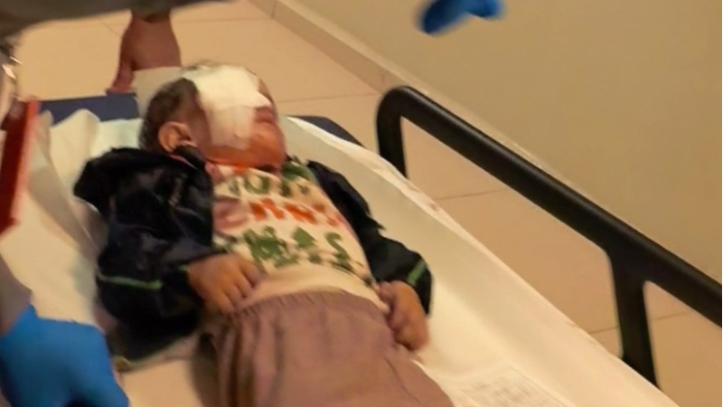 Bursa'da patlayan torpil 2 yaşındaki çocuğu bu hale getirdi!